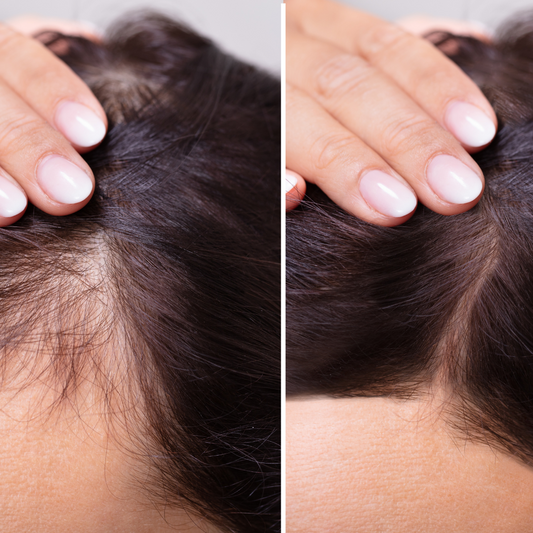 Understanding Hair Loss: Causes, Treatments, and Prevention